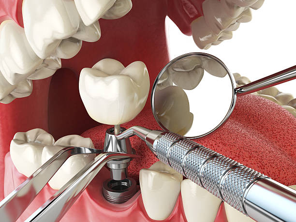 Best Emergency Dental Services for Seniors in Hummelstown, PA